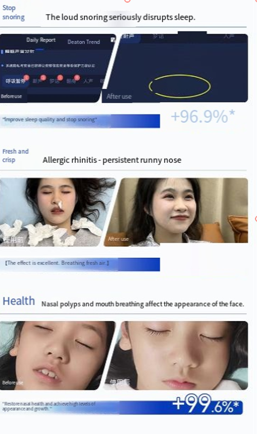 Trate várias rinites, o adesivo de sensibilidade nasal infravermelho pode aliviar rapidamente sintomas como congestão nasal, coceira e coriza causada por rinite alérgica e crônica.  Se você fizer um pedido hoje, receberá um total de 5 caixas, com cada caixa contendo 6 adesivos.  Tome um adesivo por dia para um tratamento de 5 caixas.