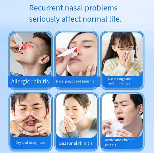 Trate várias rinites, o adesivo de sensibilidade nasal infravermelho pode aliviar rapidamente sintomas como congestão nasal, coceira e coriza causada por rinite alérgica e crônica.  Se você fizer um pedido hoje, receberá um total de 5 caixas, com cada caixa contendo 6 adesivos.  Tome um adesivo por dia para um tratamento de 5 caixas.