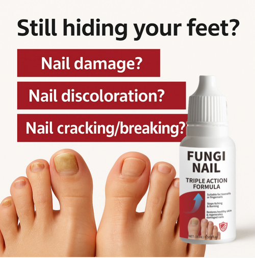 If you place an order today, you will receive 4 bottles of anti-fungal nail repair solution. It works by interfering with the synthesis of the fungal cell membrane, inhibiting the growth and reproduction of fungi, shrinking the nail plate, repairing damaged nail plates, promoting the growth of new nails, improving nail quality, and alleviating itching caused by fungal infections. One course consists of 4 bottles, allowing you to regain healthy nails.