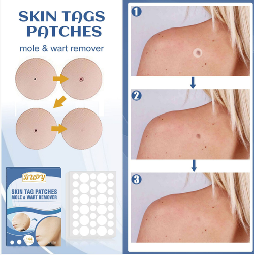 Adesivos para remoção de verrugas para verrugas genitais e outras lesões verrucosas.  Os adesivos contêm vitamina E + óleo de árvore do chá.  Uma vez aplicadas, elas se tornam invisíveis.  Em 7 a 14 dias, os acordões de pele vão cair naturalmente.  É não invasivo, indolor e não danifica a pele. 144 adesivos em um pacote grande.  Faça um pedido hoje e você receberá 2 caixas na entrega.  É suficiente para uso doméstico.  Não haverá cicatrizes após a aplicação.  A pele vai ficar lisa e confortável!