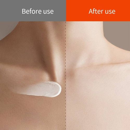 This scar and burn wound repair cream is specially designed to treat surgical scars, burn marks, and hypertrophic scars. It has a smooth texture that is easy to absorb. It has 6 layers of repair power, which can soften hard scars and lighten pigmentation. If you place an order today, you will receive 3 boxes, which is enough for about half a year's usage. It can hide the marks and help you regain confidence in showing your skin. The cost-performance ratio is absolutely perfect!