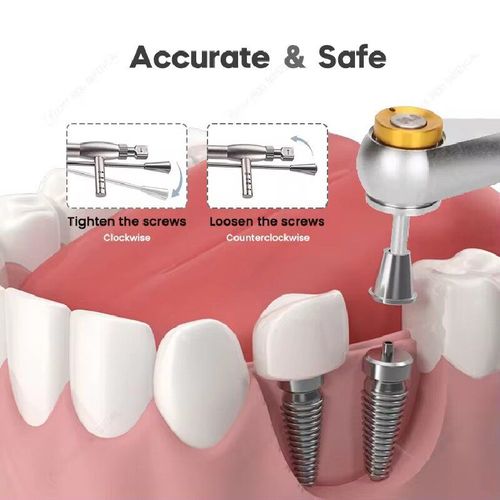 Dental Universal Implant Restoration Tool Kit Set: 16 multi-system compatible screwdrivers 10-70Ncm adjustable precision torque wrench made of high-hardness medical stainless steel material supporting 135° high-temperature sterilization compatible with ITI Odontex Denton and other multi-brand implant systems specialized for oral implant surgeries abutment restorations precise torque tools