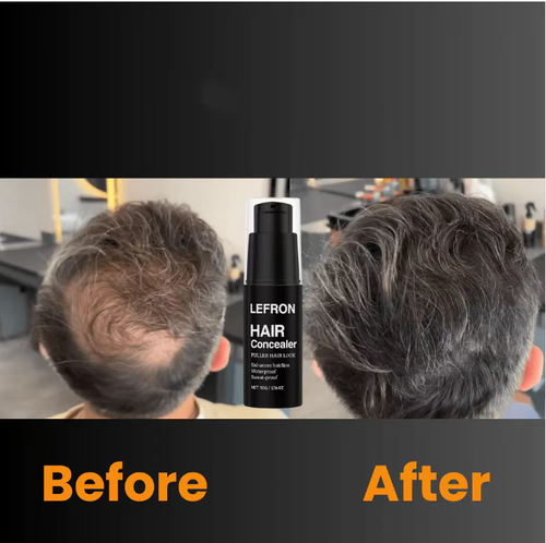 Hoje, você pode comprar 2 frascos de corretivo Magic Hair!O tipo cremoso preenche com precisão as frestas do cabelo,com uma textura hidratante que não deixa o cabelo com um fio excessivamente branco.Dura 7 dias e é à prova d'água e à prova de suor,então não vai sair durante o trajeto ou treino.  Também é feito com ingredientes de origem vegetal que protegem o couro cabeludo.  Leva apenas 1 minuto para criar volume natural do cabelo, e isso dobra o efeito para um visual ainda mais impressionante!