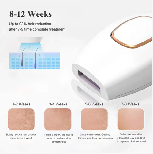 White Gold Hair Removal Device, pulse light to inhibit hair roots, 92% hair removed in 8 weeks: hair growth slows down in 1-2 weeks, hair volume decreases in 3-4 weeks, and there is almost no hair left after 8 weeks. The White Gold body is comfortable to hold, with gentle energy that is gentle on sensitive skin. You can enjoy full freedom of clothing throughout the year without worrying about showing skin.
