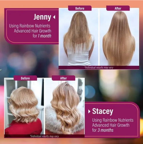 Se você fizer um pedido hoje, enviaremos um total de 2 frascos de cápsulas vitamínicas para fortalecer o cabelo.  A quantidade total é de 240 cápsulas.  As cápsulas avançadas de crescimento capilar contêm 10.000 microgramas de biotina e colágeno.  Eles ajudam a prevenir a queda de cabelo e deixam o cabelo mais grosso.  Tome 2 cápsulas por dia.  Além disso, também possui efeitos de cuidados com a pele e fortalecimento das unhas.  Seus ingredientes são puros e não contêm aditivos.