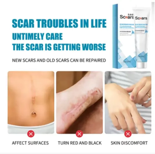 Se você fizer um pedido hoje, receberá 5 caixas de Gel Antibacteriano e Anticicatriz Jiugutang Ervas para Cicatrizes.  Esse gel reparador de cicatrizes é projetado para tratar vários tipos de cicatrizes.  Os extratos de alcaçuz, raiz e cebola ajudam a inibir o crescimento das cicatrizes, enquanto peptídeos de pequenas moléculas promovem a cicatrização e deixam a pele mais macia.  Também pode reduzir a pigmentação e restaurar a textura lisa da pele!