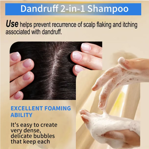 Faça o pedido hoje e você receberá 2 frascos de shampoo Thai ginger herbal essence que remove efetivamente óleo, caspa e deixa o cabelo liso e brilhante.  Ele contém suco de gengibre fresco, que pode fortalecer as raízes do cabelo e reduzir a queda de cabelo.  A essência de limão pode controlar a secreção de óleo e a caspa.  A espuma rica é suave, mas eficaz, e pode limpar o couro cabeludo.  Após a lavagem, as raízes do cabelo ficam fofas, criando um penteado refrescante e em camadas.