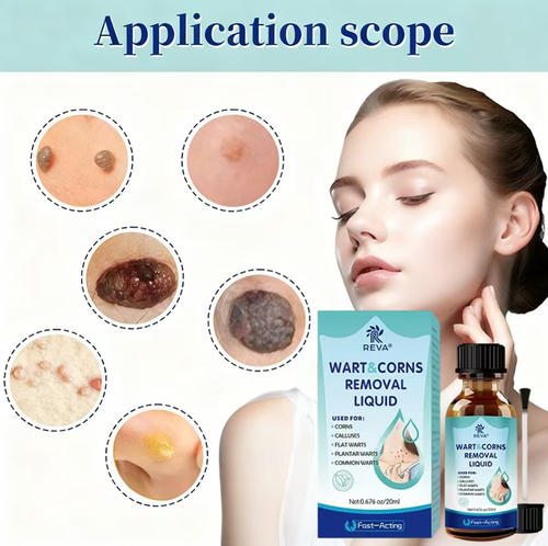 Faça o pedido hoje e você receberá 3 frascos de essência sérica 100% natural à base de plantas, desenvolvida por um médico da pele, para remover pintas e verrugas.  Utiliza uma fórmula suave à base de plantas e não causa irritação.  O design preciso da cabeça do pincel garante que não contaminará a pele saudável.  Ele pode facilmente lidar com problemas como pintas, verrugas e calos, oferecendo serviços convenientes de reparo em casa para restaurar a pele lisa e bonita.