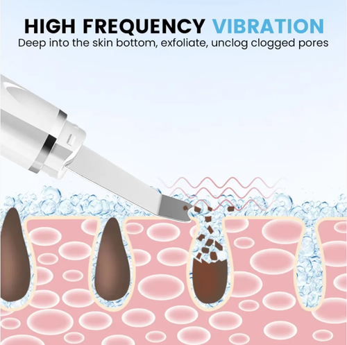 Raspador elétrico ultrassônico para a pele com vibração de alta frequência para atomizar e remover a sujeira dos poros, sem danificar a barreira da pele.  Esse único aparelho faz de tudo – limpeza profunda, esfoliação e iluminação da pele.  Diga adeus ao nariz de morango e à textura áspera da pele, e dobre a absorção dos produtos para cuidados com a pele.  Compacto e portátil, você pode desfrutar de limpeza profissional em casa e cultivar uma pele transparente semelhante a um ovo.