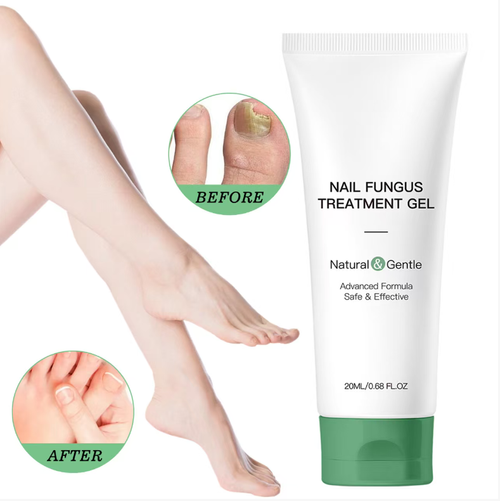 Faça o pedido hoje e você receberá 3 caixas de gel antibacteriano natural para cuidados com unhas.  Este gel natural e suave para unhas tem três funções: antifúngico, reparador e hidratante.  Ajuda a melhorar as unhas em casos de infecções fúngicas, assim como nas secas e frágeis.  É conveniente para cuidados domiciliares e pode restaurar a saúde e o brilho das unhas.  Torne cada sessão de cuidados suave e eficaz, e traga suas unhas de volta a um estado saudável e brilhante.