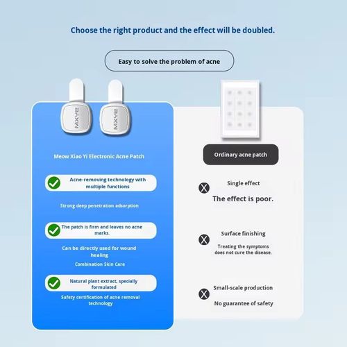 MXYE Advanced Meow Xiao Yi Adesivo Eletrônico para Acne com Tecnologia de Microchip de Precisão, Luz Azul de 460nm para Eliminação de Acne por Propionibactéria e Luz Vermelha de 630nm para Reparo Anti-Inflamatório, Infundido com Ácido Salicilítico, Centella Asiatica & Calendula, Adesivo de Tratamento de Acne Isolante Hidrocoloide para Acne Cística, Espinhas e Pele Propensa à Acne, Penetração Profunda Forte, Sem Marcas de Acne, Seguro para Cicatrização de Feridas