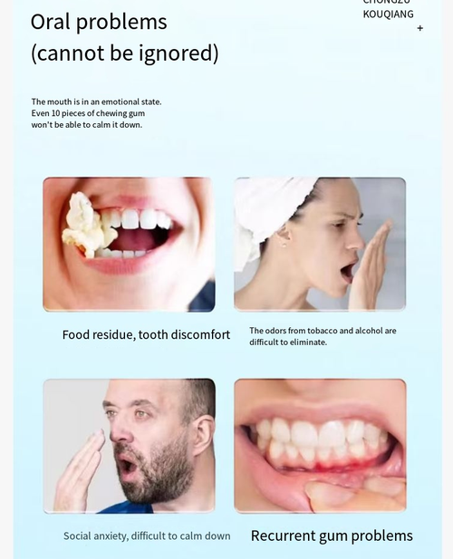 Após fazer o pedido, você receberá 10 frascos de spray de restauração de cáries dentárias, remoção de placa, tártaro, clareamento dental e polimento.  Utiliza uma fórmula enzimática suave e pode produzir espuma espessa, que pode limpar profundamente as áreas de difícil acesso da boca, dissolver manchas, reduzir placas, e seu design apresenta um design de botão de pressão.  É conveniente de usar e higiênico.  Até pessoas com dentes sensíveis podem usá-lo com confiança.