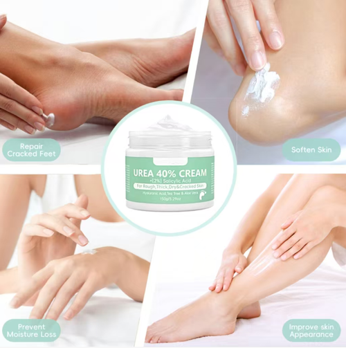 Faça o pedido hoje e você receberá 3 caixas de creme antibacteriano natural para cicatrização.  Esse creme pode inibir fungos, reparar a pele, aliviar a coceira e também contém árvore do chá, aloe vera e ácido hialurônico.  Ele pode amolecer células mortas da pele, reparar áreas secas e rachadas, proporcionar efeitos hidratantes duradouros e é adequado para pele áspera das mãos, pés e de todo o corpo.  Tem uma textura suave e é fácil de absorver.