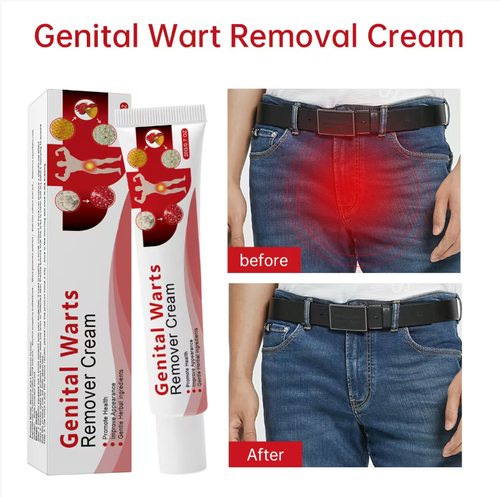 Se você fizer um pedido hoje, receberá 10 caixas do creme de remoção de verrugas genitais de ação rápida e leve para cuidados com a pele.Este creme para remoção de verrugas e suavização da textura da pele contém ingredientes herbais suaves e não contém componentes irritantes ou antibacterianos.Ele pode tratar vários tipos de verrugas e melhorar a textura áspera da pele.Este produto é portátil e conveniente para você usar a qualquer momento,permitindo recuperar uma pele lisa e delicada,saudável.