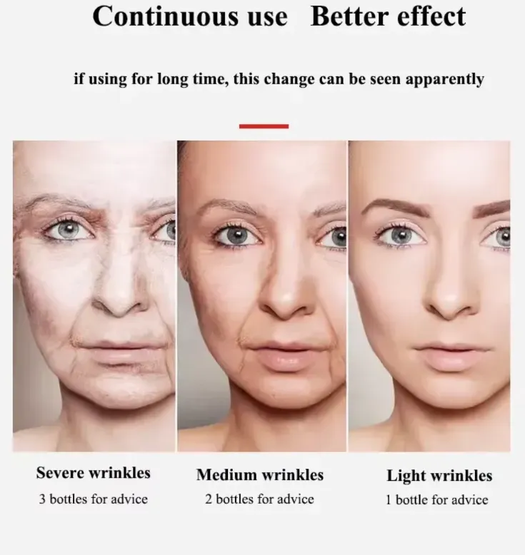 Faça o pedido hoje e você receberá 10 caixas de Golden Collagen Anti-Wrinkle Cream. Ele pode reduzir linhas finas e pregos nasolabiais com colágeno de alta atividade, e combina com fatores hidratantes para reter a umidade. A textura é suave e fácil de absorver, gentil e não irritante, adequada para todos os tipos de pele. Use pela manhã e à noite para deixar sua pele lisa e firme, proporcionando uma boa tez mesmo sem maquiagem.