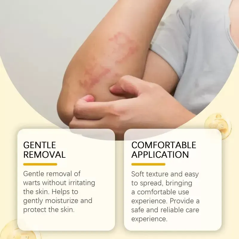 Hoje,estamos lançando 3 frascos do Bee Venom Care Cream.Cada tubo pode aliviar a secura,vermelhidão e aspereza!Extrato de consolda com veneno de abelha,ele repara e retém a umidade,amolece a pele e é absorvido instantaneamente com uma textura parecida com manteiga.  Em 15 minutos, a sensação de ardor diminui, a vermelhidão e os vasos sanguíneos desaparecem, e os poros ficam menores.  Os ventiladores antigos elogiam como sem recorrência de secura e coceira,e as juntas estão lisas e escorregadias!