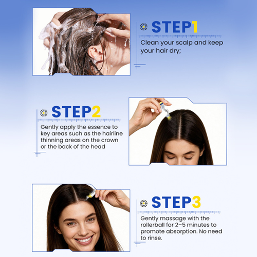 Cabelo fino, raízes fracas?Experimente a essência para crescimento do tratamento Rolling Ball para o couro cabeludo.Role suavemente e ele hidratará profundamente,fortalecerá as raízes do cabelo e proporcionará uma penetração profunda no couro cabeludo em apenas 30 segundos.  É refrescante e não oleosa.  Peça hoje e adquira 5 garrafas.  É suficiente para as necessidades de cuidados capilares de todo o trimestre.Você terá um cabelo cascata volumoso com o dobro do efeito visual do volume do cabelo!