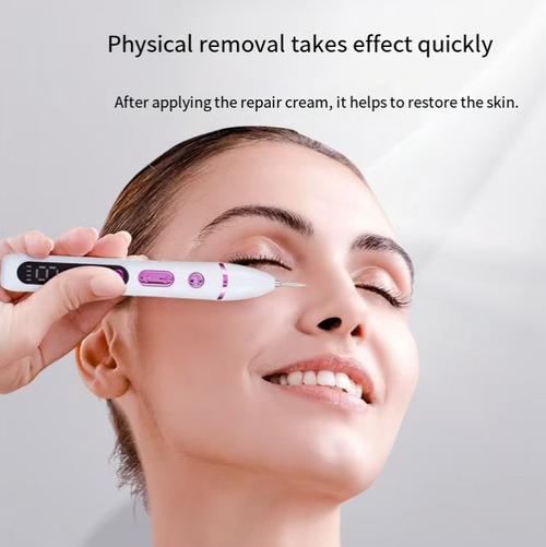 Caneta de tatuagem facial para casa, um clique para clarear as imperfeições, Com 5 configurações ajustáveis, a caneta é leve e conta com uma tela digital para indicar as configurações.  Ele pode ser carregado e tem uma longa duração da bateria.  Pode ser usado tanto em casa quanto durante viagens.  A operação é tão simples quanto segurar uma caneta.  Ele economiza custos em salões de beleza e permite que você realce facilmente seu tom natural de pele, alcançando uma textura suave e delicada!