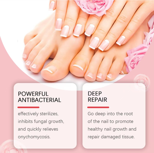 Faça o pedido hoje e você receberá 3 frascos do hidratante herbal Gentle para unhas recomendado pelo médico de pele.  Este produto utiliza energia vegetal para reparar suavemente as unhas danificadas, permitindo que você recupere uma superfície da unha saudável e brilhante.  A fórmula da essência é suave em suas propriedades antibacterianas, reparando efetivamente as unhas danificadas, adequado para pessoas com onicomicose e para quem precisa de reparo após manicure.