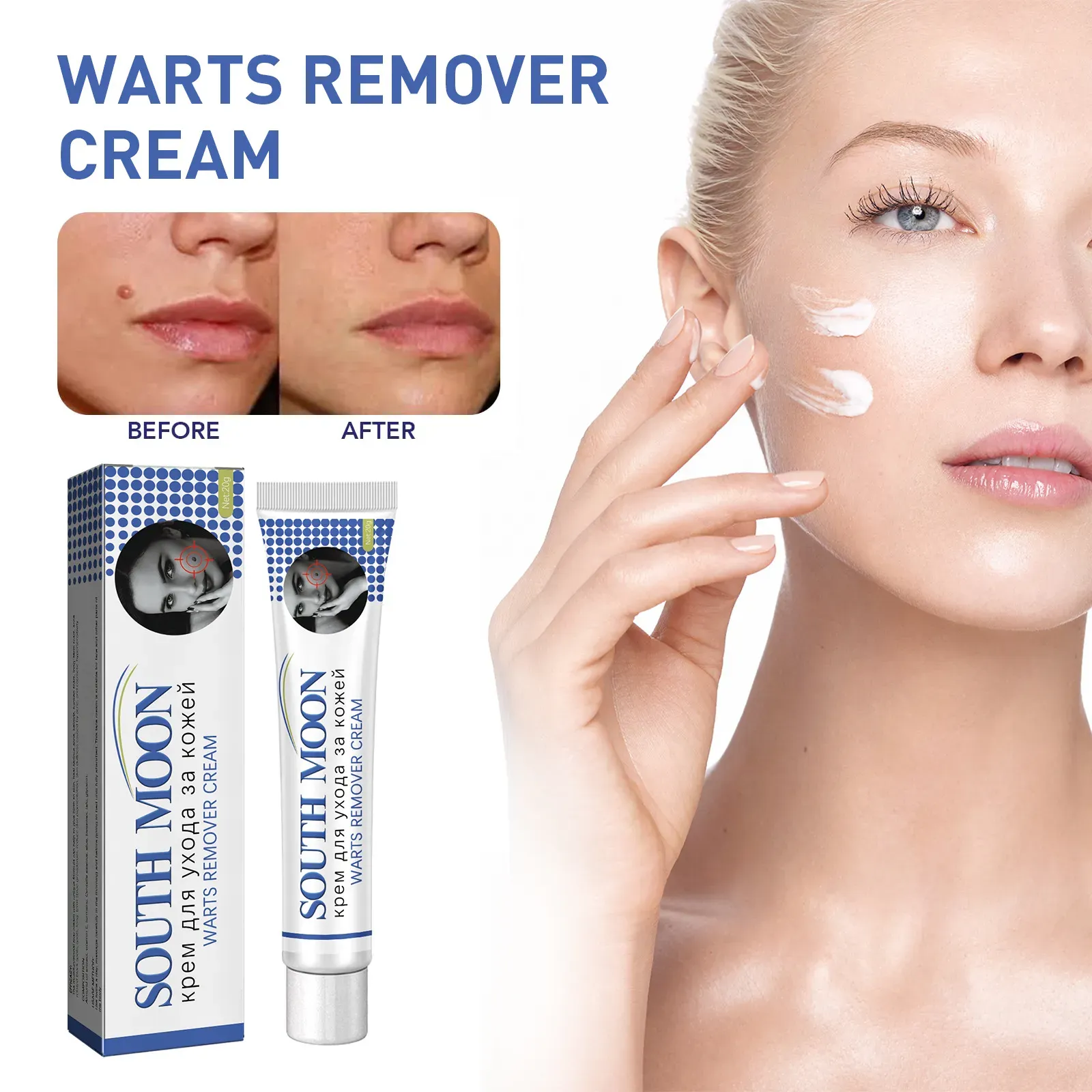 Creme de Ceratose para Pele Corporal.  Pedi hoje, recebi 5 tubos.  Fórmula natural, adequada para todos os tipos de pele, trata várias imperfeições, como hiperplasia cutânea, pintas claras, pintas escuras, verrugas grandes, calos, etc.  O processo de cuidados domiciliares consiste em três etapas simples (limpeza - aplicação - continuação), garantindo segurança e suavidade durante o desbotamento e remoção das imperfeições.  Veja sua pele se transformar de imperfeições evidentes para lisa e limpa.