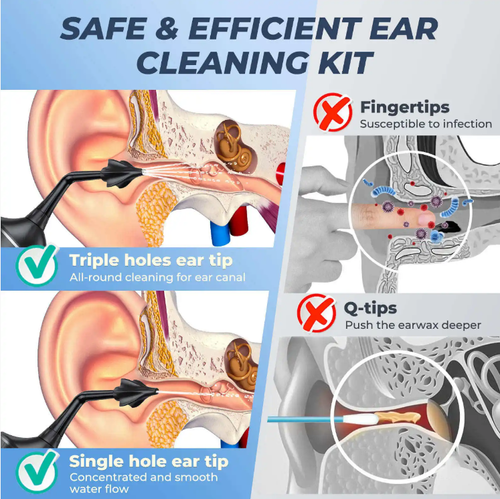 Este limpador elétrico utiliza um fluxo suave de água para limpar o canal auditivo com segurança, eliminando os riscos associados ao uso de cotonetes!  Os modos de limpeza com ponta de borracha macia + 4 são adequados para idosos, crianças e pessoas com canais auditivos sensíveis.  IPX7 à prova d'água + carregamento USB, com um reservatório de água de 300ml suficiente para uso.  Você pode desfrutar de um SPA relaxante no canal auditivo em casa, e pode ser usado por toda a família!