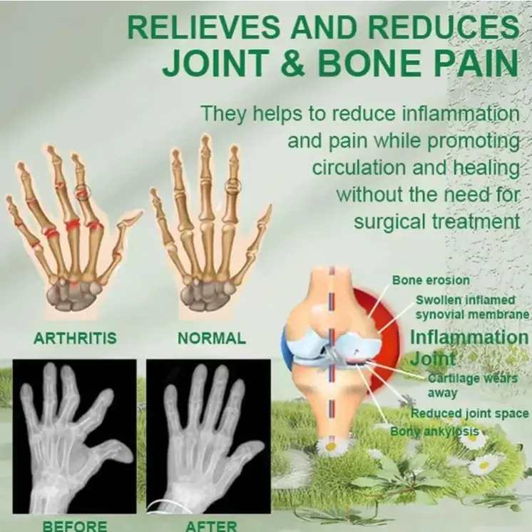 Gel, Gel, Gel, Compressa Fria da região lombar, a essência herbal penetra profundamente, aliviando rapidamente a dor e a rigidez na região lombar. O design de prensa e spray permite a aplicação fácil a qualquer hora e em qualquer lugar. Faça o pedido hoje e receba 2 garrafas. Não deixe a dor lombar se tornar um problema grave. Dê um impulso para a saúde da sua região lombar agora!