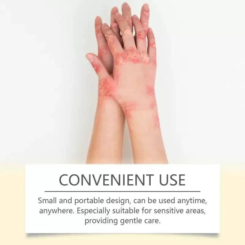 Hoje,estamos lançando 3 frascos do Bee Venom Care Cream.Cada tubo pode aliviar a secura,vermelhidão e aspereza!Extrato de consolda com veneno de abelha,ele repara e retém a umidade,amolece a pele e é absorvido instantaneamente com uma textura parecida com manteiga.  Em 15 minutos, a sensação de ardor diminui, a vermelhidão e os vasos sanguíneos desaparecem, e os poros ficam menores.  Os ventiladores antigos elogiam como sem recorrência de secura e coceira,e as juntas estão lisas e escorregadias!