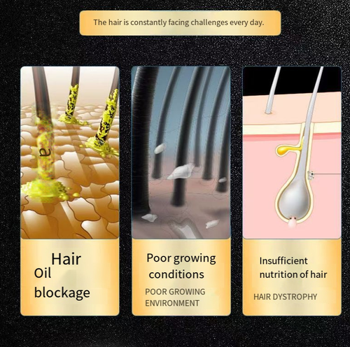 Faça o pedido hoje e você receberá 2 frascos de Shampoo Anti-Queda de Cabelo White Hack.Contém extratos de wolfberry + ervas.  Após cada uso, fortalece as raízes do cabelo, reduz a queda de cabelo e promove o crescimento de cabelo espesso.  A espuma é espessa e pode remover gordura.  Cabelos oleosos ficam macios e fofos.  Após a lavagem, o cabelo fica hidratado e não com frizz.  É adequado para couros cabeludos sensíveis e pode ser usado sem revelar o couro cabeludo ao usar um penteado em coque.