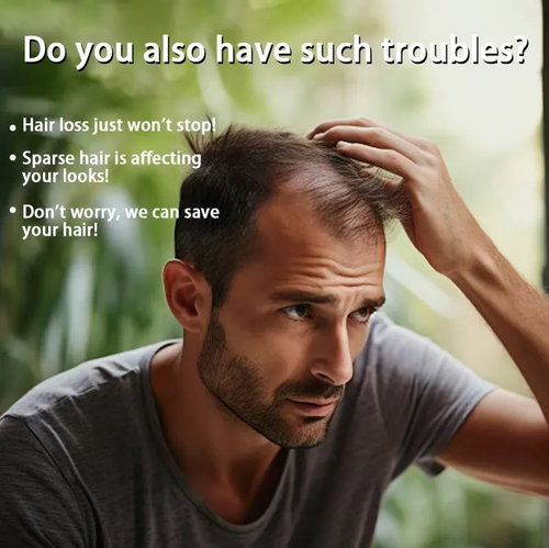 Pegue rápido o produto estrela que mata o frizz! Essência extrativa de óleo de batana. Basta uma aplicação para domar o frizz, nutrir as raízes e reduzir a quebra. Também pode deixar seu cabelo macio e brilhante mesmo após sentar no sofá, passar por permanente ou colorir. Peça hoje e compre 3 garrafas. Uma garrafa dura cerca de meio mês. O aroma do café permeia o cabelo, proporcionando cuidados completos com o cabelo. Este produto é perfeito para quem adora sentar no sofá. Só tente!