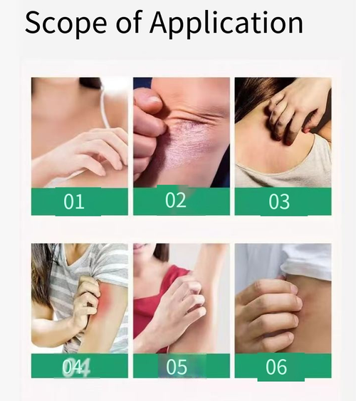 Faça o pedido hoje e você receberá 4 garrafas!  Contém ervas naturais como madressilva, que podem aliviar a coceira, vermelhidão e inchaço causados por picadas de mosquito, além do eczema.  A textura é fina e fácil de absorver.  Ele vem em um tubo portátil, tornando-o conveniente para usar a qualquer momento.  É uma escolha ideal para os cuidados com a pele de todos os membros da família.