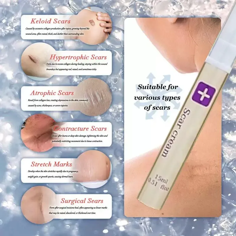 Scar Care Gel, um tubo cobre 20cm de cicatriz, 3 caixas (peça hoje e compre 3 caixas, que podem cobrir 60cm).  Pode reparar 60cm de cicatrizes hipertróficas macias, marcas leves de acne, cicatrizes cirúrgicas e reduzir linhas de gravidez.  O gel transparente não é pegajoso e pode ser usado para peles sensíveis após a cirurgia.  Aplique diariamente, e a cicatriz vai ficando gradualmente plana, macia e limpa.  Não há necessidade de cobrir a pele exposta.  Recupero a confiança facilmente.