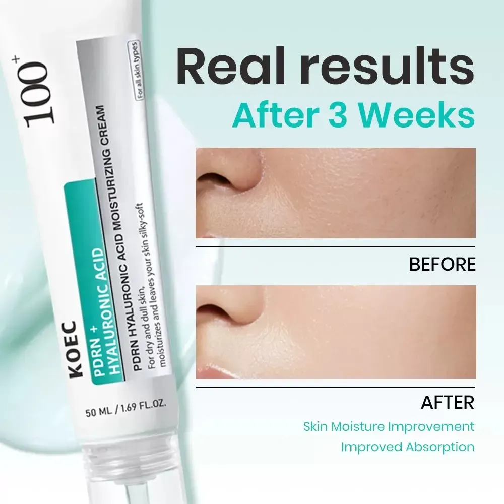 Pele seca, olhos cansados com opacidade?  Não espere mais!  Faça o pedido hoje e enviaremos 2 frascos de creme hidratante anti-rugas.  Ele combina o DPRN rei reparador e o ácido hialurônico gigante da hidratação, O ácido hialurônico de alta concentração é como um pequeno reservatório, penetrando instantaneamente profundamente na camada da pele quando aplicado, e pode deixar o nariz e as áreas sob os olhos macios e úmidas, mesmo como quem usa pó de Kaka.