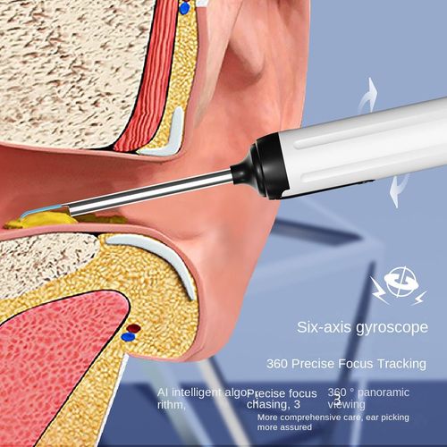 Intelligent visual ear spoon