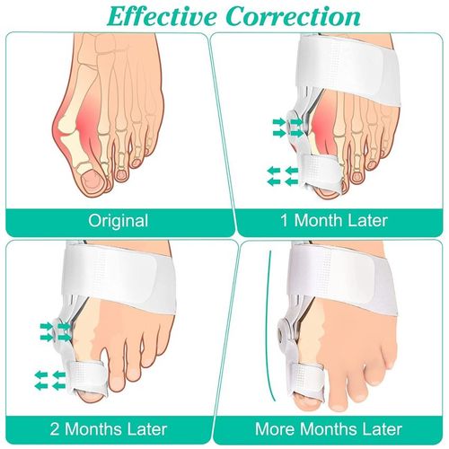 Toe Corrector