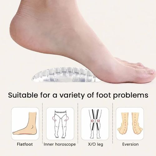 Arch Support