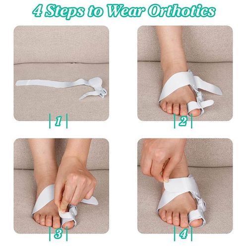 Toe Corrector