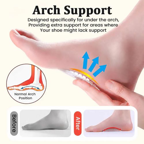 Arch Support