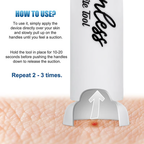 🦟 Experience Instant Relief ✨ Ultimate Bite & Sting Relief Tool - For Itch-Free, Comfortable Days!