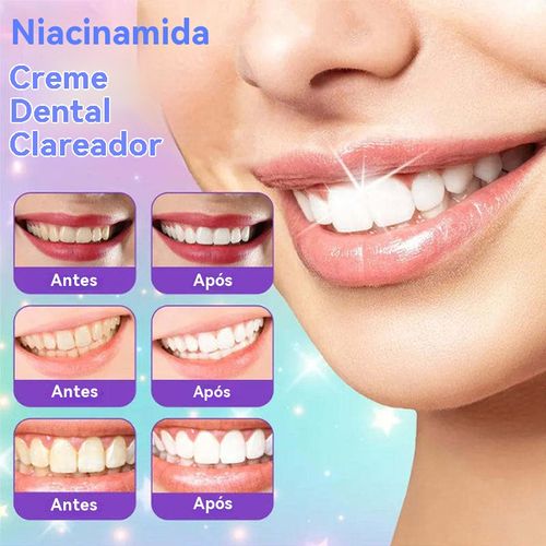 Com Escova Grátis BodyAccel Niacinamida - Branqueamento Dental Profissional em 7 Dias! Elimina Placa, Tártaro e Sensibilidade Nas Gengivas. Para Toda Família!