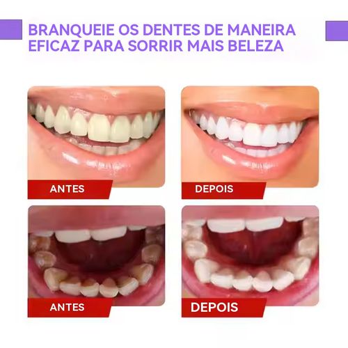 Creme Dental Probiótico — eficaz contra dentes amarelados e mau hálito, limpa profundamente, mantém o hálito fresco por mais tempo, branqueia os dentes, previne cáries e protege suavemente as gengivas.