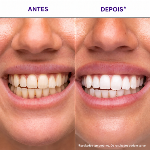 Hismile V34 Tiras de Branqueamento Dentário | Angola
