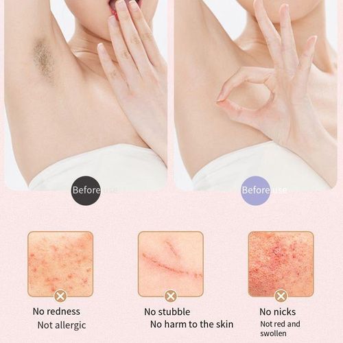 🏆Flash Sale⚡ 50K+ SOLD! Almost Gone-💥🔥 Comfort 2 in 1 Electric Lady Shaver,Best Gifts ⚡Buy More Save More⚡⚡Sale ends in 2 days❤️