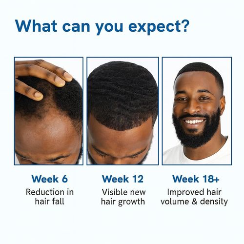 Be Bodywise Rosemary Hair Growth Roll-On Serum contains 3% rosemary, 3% redensy, and 2% anagain. This DHT-inhibiting scalp serum promotes oxygen delivery and reduces hair loss. Paraben-free and suitable for both men and women.