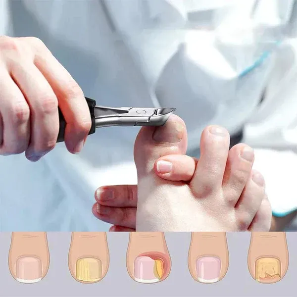 Professional Grade Concave Stainless Steel Nail Clippers for Thick Nails and Ingrown Toenails Sharp Curved Blade for Easy Trimmi