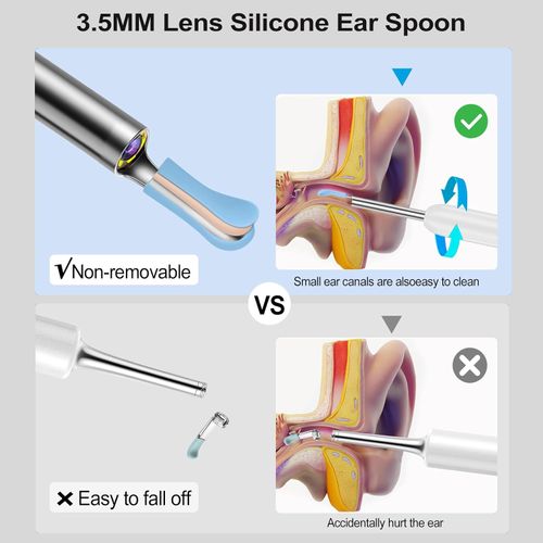 Ear Wax Removal, Ear Cleaner with Camera with 1080P, Ear Wax Removal Tool with 6 LED Light, Ear Wax Removal Kit with 8 Ear Pick, Ear Camera for iPhone, iPad, Android Phones(black)