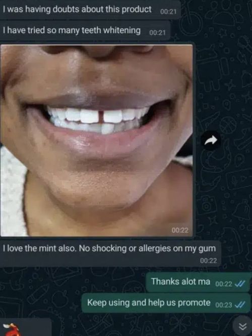 Purple Teeth Whitening Strips – Gentle Daily Purple Whitening Strips for Surface Stain Reduction & Natural Shine, Portable Whitening Strips Purple for Home or On-The-Go Use