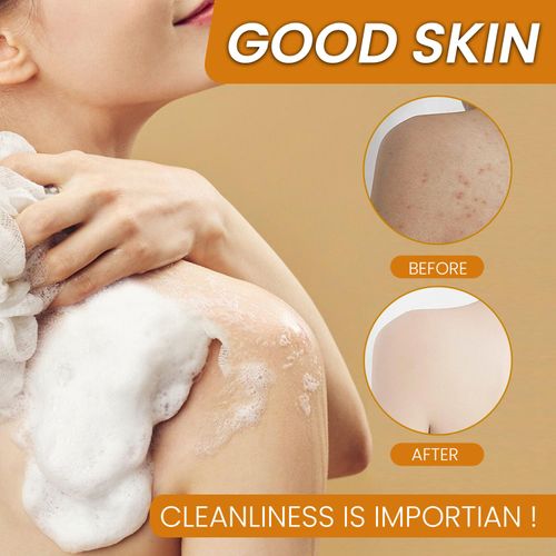 Turmeric Soap Bar, Organic Turmeric Soap for Dark Spots & Acne, for Hyperpigmentation, Smooth Skin, All Natural Turmeric Soap Bar, Deep Cleansing Turmeric Soap(Foaming net included)