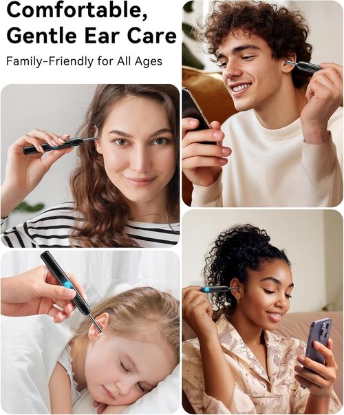 Ear Wax Removal, Ear Cleaner with Camera with 1080P, Ear Wax Removal Tool with 6 LED Light, Ear Wax Removal Kit with 8 Ear Pick, Ear Camera for iPhone, iPad, Android Phones(black)