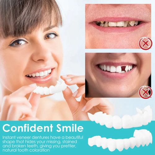 Adjustable Dentures