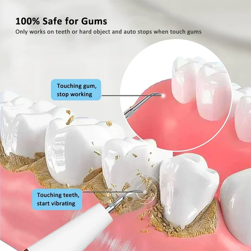 MJAA™-Ultrasonic Tooth Cleaner | White Teeth in Minutes